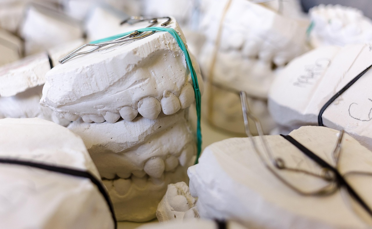 Ceramic inlay / onlay dental filling — Odonto Lahore